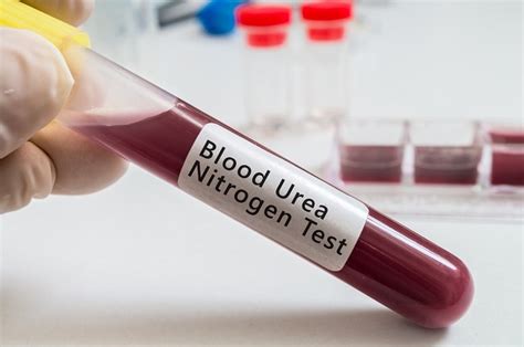 Blood urea nitrogen (BUN) test .